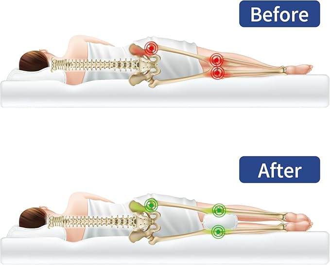 HOMBYS Knee Pillow for Side Sleepers with Groove, Down Alternative Between Leg Pillow for Sleeping,Under Knee Pillow for Sleeping on Back,Spine Alignment, Lower Back Pain Relief, Machine Washable